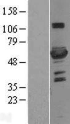 Western Blot: 6 Phosphofructo 2 Kinase Overexpression Lysate (Adult Normal) [NBL1-14312] Left-Empty vector transfected control cell lysate (HEK293 cell lysate); Right -Over-expression Lysate for 6 Phosphofructo 2 Kinase.