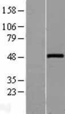 Western Blot: Wnt10a Overexpression Lysate (Adult Normal) [NBL1-17861] Left-Empty vector transfected control cell lysate (HEK293 cell lysate); Right -Over-expression Lysate for Wnt10a.