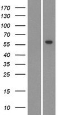 Western Blot: CYP26C1 Overexpression Lysate (Adult Normal) [NBP2-04787] Left-Empty vector transfected control cell lysate (HEK293 cell lysate); Right -Over-expression Lysate for CYP26C1.