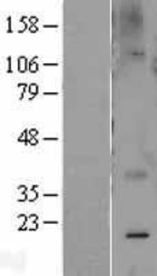 Western Blot: Caveolin 2 Overexpression Lysate (Adult Normal) [NBL1-08730] Left-Empty vector transfected control cell lysate (HEK293 cell lysate); Right -Over-expression Lysate for Caveolin 2.