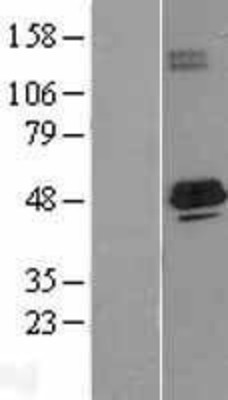 Western Blot: ACADS Overexpression Lysate (Adult Normal) [NBL1-07221] Left-Empty vector transfected control cell lysate (HEK293 cell lysate); Right -Over-expression Lysate for ACADS.