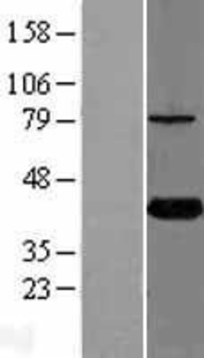 Western Blot: KTI12 Overexpression Lysate (Adult Normal) [NBL1-12415] Left-Empty vector transfected control cell lysate (HEK293 cell lysate); Right -Over-expression Lysate for KTI12.