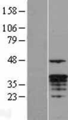 Western Blot: Granzyme M Overexpression Lysate (Adult Normal) [NBL1-11420] Left-Empty vector transfected control cell lysate (HEK293 cell lysate); Right -Over-expression Lysate for Granzyme M.