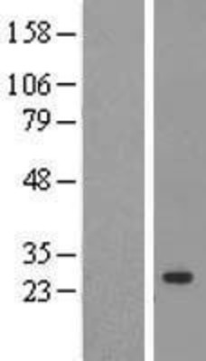 Western Blot: Cyclophilin C Overexpression Lysate (Adult Normal) [NBL1-14647] Left-Empty vector transfected control cell lysate (HEK293 cell lysate); Right -Over-expression Lysate for Cyclophilin C.