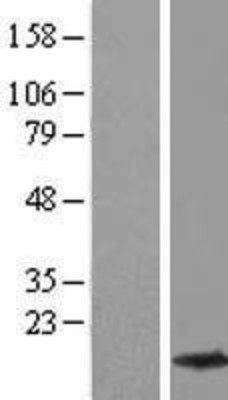 Western Blot: beta-Synuclein Overexpression Lysate (Adult Normal) [NBL1-16276] Left-Empty vector transfected control cell lysate (HEK293 cell lysate); Right -Over-expression Lysate for beta-Synuclein.