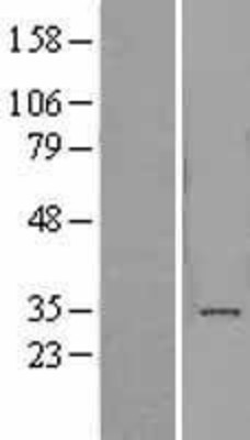 Western Blot: ADAL Overexpression Lysate (Adult Normal) [NBL1-07304] Left-Empty vector transfected control cell lysate (HEK293 cell lysate); Right -Over-expression Lysate for ADAL.