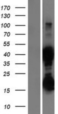 Western Blot: ASRGL1 Overexpression Lysate (Adult Normal) [NBP2-06243] Left-Empty vector transfected control cell lysate (HEK293 cell lysate); Right -Over-expression Lysate for ASRGL1.