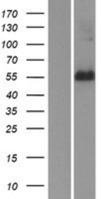 Western Blot: FAM134A Overexpression Lysate (Adult Normal) [NBP2-06341] Left-Empty vector transfected control cell lysate (HEK293 cell lysate); Right -Over-expression Lysate for FAM134A.