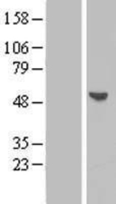 Western Blot: BPIL1 Overexpression Lysate (Adult Normal) [NBP2-06208] Left-Empty vector transfected control cell lysate (HEK293 cell lysate); Right -Over-expression Lysate for BPIL1.