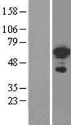 Western Blot: FOXC2 Overexpression Lysate (Adult Normal) [NBL1-10802] Left-Empty vector transfected control cell lysate (HEK293 cell lysate); Right -Over-expression Lysate for FOXC2.