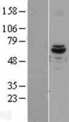 Western Blot: ACAD9 Overexpression Lysate (Adult Normal) [NBL1-07219] Left-Empty vector transfected control cell lysate (HEK293 cell lysate); Right -Over-expression Lysate for ACAD9.