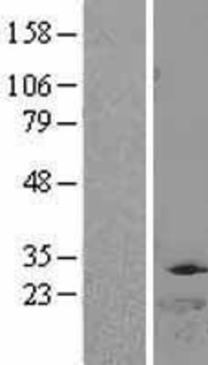 Western Blot: DTYMK Overexpression Lysate (Adult Normal) [NBL1-10039] Left-Empty vector transfected control cell lysate (HEK293 cell lysate); Right -Over-expression Lysate for DTYMK.
