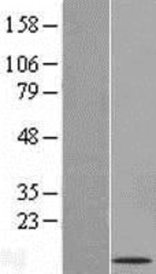 Western Blot: GCET2 Overexpression Lysate (Adult Normal) [NBL1-11004] Left-Empty vector transfected control cell lysate (HEK293 cell lysate); Right -Over-expression Lysate for GCET2.