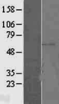 Western Blot: ERM/Etv5 Overexpression Lysate (Adult Normal) [NBL1-10361] Left-Empty vector transfected control cell lysate (HEK293 cell lysate); Right -Over-expression Lysate for ERM/Etv5.