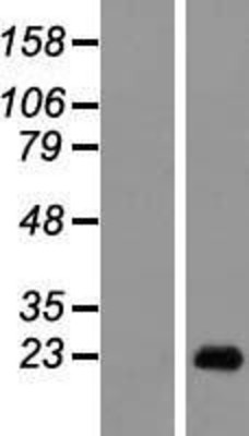 Western Blot: DEFB129 Overexpression Lysate (Adult Normal) [NBL1-09825] Left-Empty vector transfected control cell lysate (HEK293 cell lysate); Right -Over-expression Lysate for DEFB129.