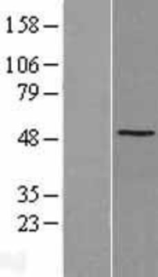 Western Blot: SSB Overexpression Lysate (Adult Normal) [NBL1-16464] Left-Empty vector transfected control cell lysate (HEK293 cell lysate); Right -Over-expression Lysate for SSB.