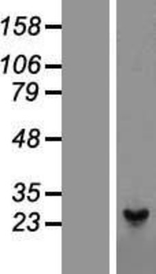 Western Blot: Peroxiredoxin 1 Overexpression Lysate (Adult Normal) [NBL1-14738] Left-Empty vector transfected control cell lysate (HEK293 cell lysate); Right -Over-expression Lysate for Peroxiredoxin 1.