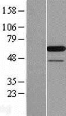 Western Blot: PAIP1 Overexpression Lysate (Adult Normal) [NBL1-14074] Left-Empty vector transfected control cell lysate (HEK293 cell lysate); Right -Over-expression Lysate for PAIP1.