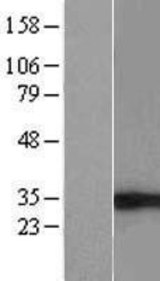 Western Blot: eIF4H Overexpression Lysate (Adult Normal) [NBL1-10212] Left-Empty vector transfected control cell lysate (HEK293 cell lysate); Right -Over-expression Lysate for eIF4H.