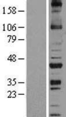 Western Blot: NOXO1 Overexpression Lysate (Adult Normal) [NBL1-13735] Left-Empty vector transfected control cell lysate (HEK293 cell lysate); Right -Over-expression Lysate for NOXO1.