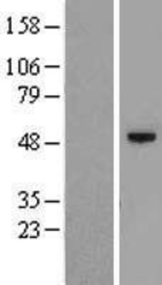 Western Blot: C12orf50 Overexpression Lysate (Adult Normal) [NBL1-08148] Left-Empty vector transfected control cell lysate (HEK293 cell lysate); Right -Over-expression Lysate for C12orf50.