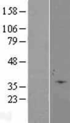 Western Blot: Caspase 6 Overexpression Lysate (Adult Normal) [NBL1-08715] Left-Empty vector transfected control cell lysate (HEK293 cell lysate); Right -Over-expression Lysate for Caspase 6.