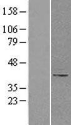 Western Blot: B4GALT1 Overexpression Lysate (Adult Normal) [NBL1-07888] Left-Empty vector transfected control cell lysate (HEK293 cell lysate); Right -Over-expression Lysate for B4GALT1.