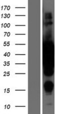 Western Blot: MEK2 Overexpression Lysate (Adult Normal) [NBL1-12847] Left-Empty vector transfected control cell lysate (HEK293 cell lysate); Right -Over-expression Lysate for MEK2.