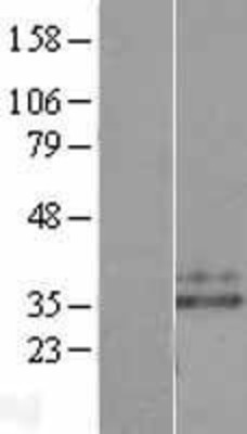 Western Blot: Neutrophil Elastase Overexpression Lysate (Adult Normal) [NBL1-10217] Left-Empty vector transfected control cell lysate (HEK293 cell lysate); Right -Over-expression Lysate for Neutrophil Elastase.