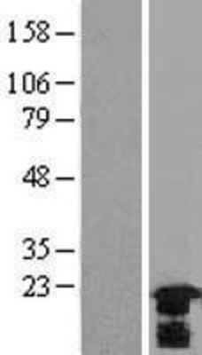 Western Blot: HspB7 Overexpression Lysate (Adult Normal) [NBL1-11760] Left-Empty vector transfected control cell lysate (HEK293 cell lysate); Right -Over-expression Lysate for HspB7.