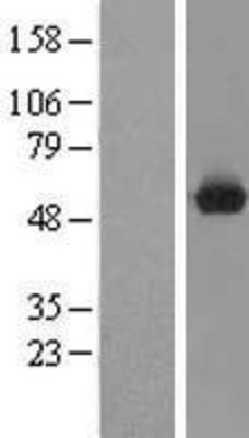 Western Blot: C9orf156 Overexpression Lysate (Adult Normal) [NBL1-08585] Left-Empty vector transfected control cell lysate (HEK293 cell lysate); Right -Over-expression Lysate for C9orf156.