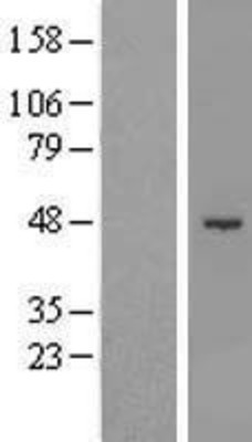Western Blot: SHMT1 Overexpression Lysate (Adult Normal) [NBL1-15947] Left-Empty vector transfected control cell lysate (HEK293 cell lysate); Right -Over-expression Lysate for SHMT1.