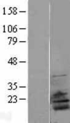 Western Blot: RPL28 Overexpression Lysate (Adult Normal) [NBL1-15521] Left-Empty vector transfected control cell lysate (HEK293 cell lysate); Right -Over-expression Lysate for RPL28.
