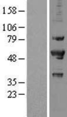 Western Blot: PRP19 Overexpression Lysate (Adult Normal) [NBL1-14817] Left-Empty vector transfected control cell lysate (HEK293 cell lysate); Right -Over-expression Lysate for PRP19.