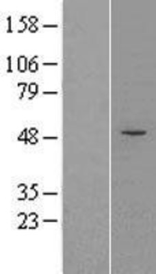 Western Blot: FcRY Overexpression Lysate (Adult Normal) [NBL1-10667] Left-Empty vector transfected control cell lysate (HEK293 cell lysate); Right -Over-expression Lysate for FcRY.