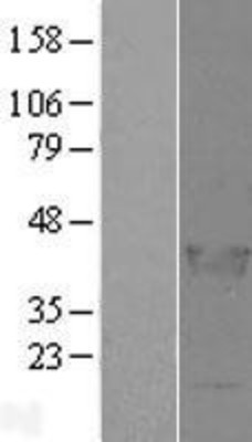 Western Blot: LCORL Overexpression Lysate (Adult Normal) [NBL1-12465] Left-Empty vector transfected control cell lysate (HEK293 cell lysate); Right -Over-expression Lysate for LCORL.