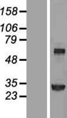 Western Blot: Transglutaminase 2 Overexpression Lysate (Adult Normal) [NBL1-16867] Left-Empty vector transfected control cell lysate (HEK293 cell lysate); Right -Over-expression Lysate for Transglutaminase 2.