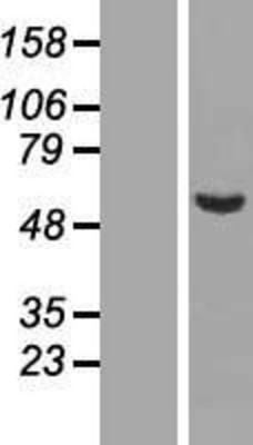 Western Blot: C9orf43 Overexpression Lysate (Adult Normal) [NBL1-08596] Left-Empty vector transfected control cell lysate (HEK293 cell lysate); Right -Over-expression Lysate for C9orf43.