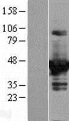 Western Blot: DOK2 Overexpression Lysate (Adult Normal) [NBL1-09978] Left-Empty vector transfected control cell lysate (HEK293 cell lysate); Right -Over-expression Lysate for DOK2.