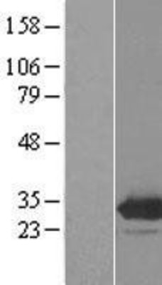 Western Blot: EMG1 Overexpression Lysate (Adult Normal) [NBL1-10254] Left-Empty vector transfected control cell lysate (HEK293 cell lysate); Right -Over-expression Lysate for EMG1.