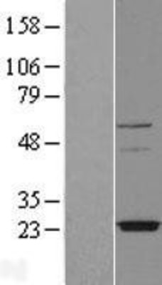 Western Blot: TMEM126A Overexpression Lysate (Adult Normal) [NBL1-17006] Left-Empty vector transfected control cell lysate (HEK293 cell lysate); Right -Over-expression Lysate for TMEM126A.