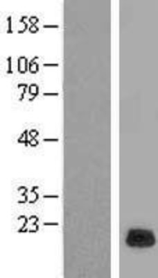 Western Blot: RPP21 Overexpression Lysate (Adult Normal) [NBL1-15553] Left-Empty vector transfected control cell lysate (HEK293 cell lysate); Right -Over-expression Lysate for RPP21.