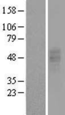 Western Blot: GPR86 Overexpression Lysate (Adult Normal) [NBL1-14041] Left-Empty vector transfected control cell lysate (HEK293 cell lysate); Right -Over-expression Lysate for GPR86.