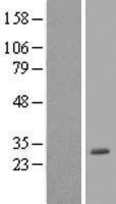Western Blot: POLR3H Overexpression Lysate (Adult Normal) [NBL1-14595] Left-Empty vector transfected control cell lysate (HEK293 cell lysate); Right -Over-expression Lysate for POLR3H.