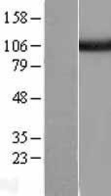 Western Blot: USP5 Overexpression Lysate (Adult Normal) [NBL1-17669] Left-Empty vector transfected control cell lysate (HEK293 cell lysate); Right -Over-expression Lysate for USP5.
