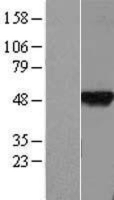 Western Blot: BTBD6 Overexpression Lysate (Adult Normal) [NBL1-08042] Left-Empty vector transfected control cell lysate (HEK293 cell lysate); Right -Over-expression Lysate for BTBD6.