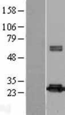 Western Blot: Peroxiredoxin-4 Overexpression Lysate (Adult Normal) [NBL1-14741] Left-Empty vector transfected control cell lysate (HEK293 cell lysate); Right -Over-expression Lysate for Peroxiredoxin-4.