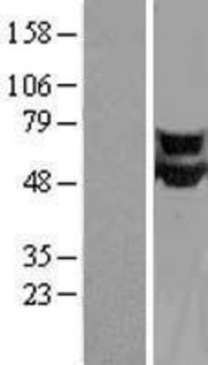 Western Blot: CPEB1 Overexpression Lysate (Adult Normal) [NBL1-09431] Left-Empty vector transfected control cell lysate (HEK293 cell lysate); Right -Over-expression Lysate for CPEB1.