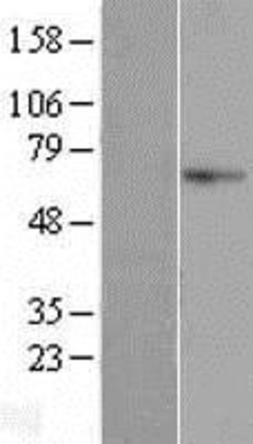 Western Blot: AIFM3 Overexpression Lysate (Adult Normal) [NBL1-07412] Left-Empty vector transfected control cell lysate (HEK293 cell lysate); Right -Over-expression Lysate for AIFM3.