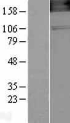 Western Blot: nNOS Overexpression Lysate (Adult Normal) [NBL1-13719] Left-Empty vector transfected control cell lysate (HEK293 cell lysate); Right -Over-expression Lysate for nNOS.